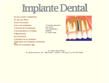 Tablet Screenshot of implantedental.com.br